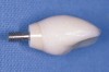 Fig 6. An all-ceramic abutment.