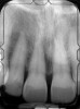 The 9-year postoperative radiograph.